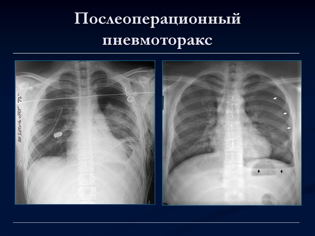 Лучевая диагностика органов дыхания презентация