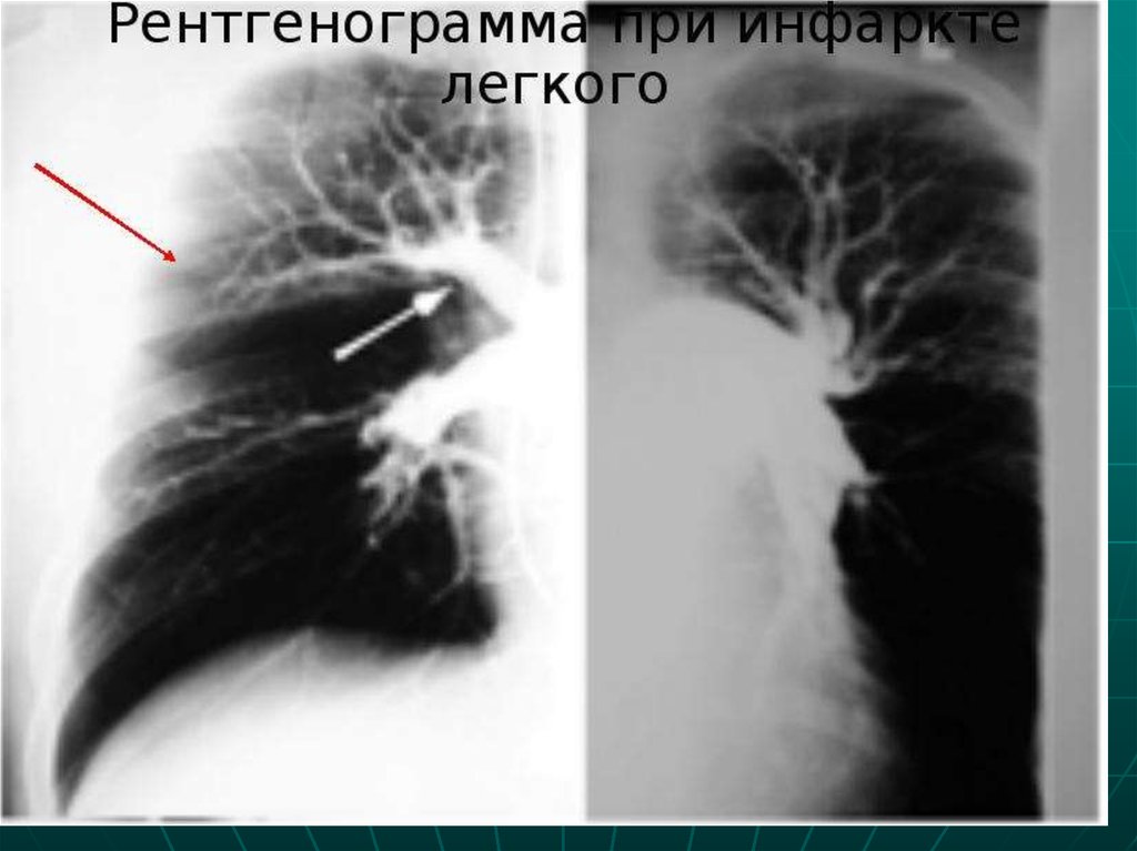 Рентген картина тэла