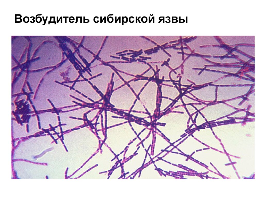 Возбудитель сибирской язвы