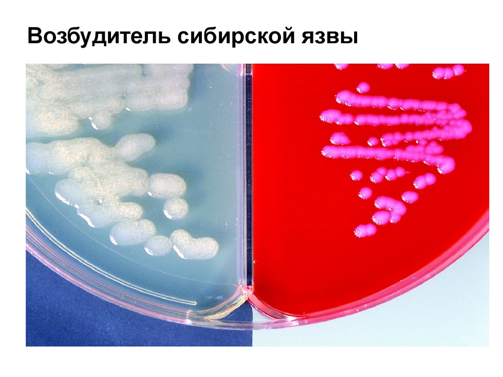 Возбудитель сибирской язвы относится