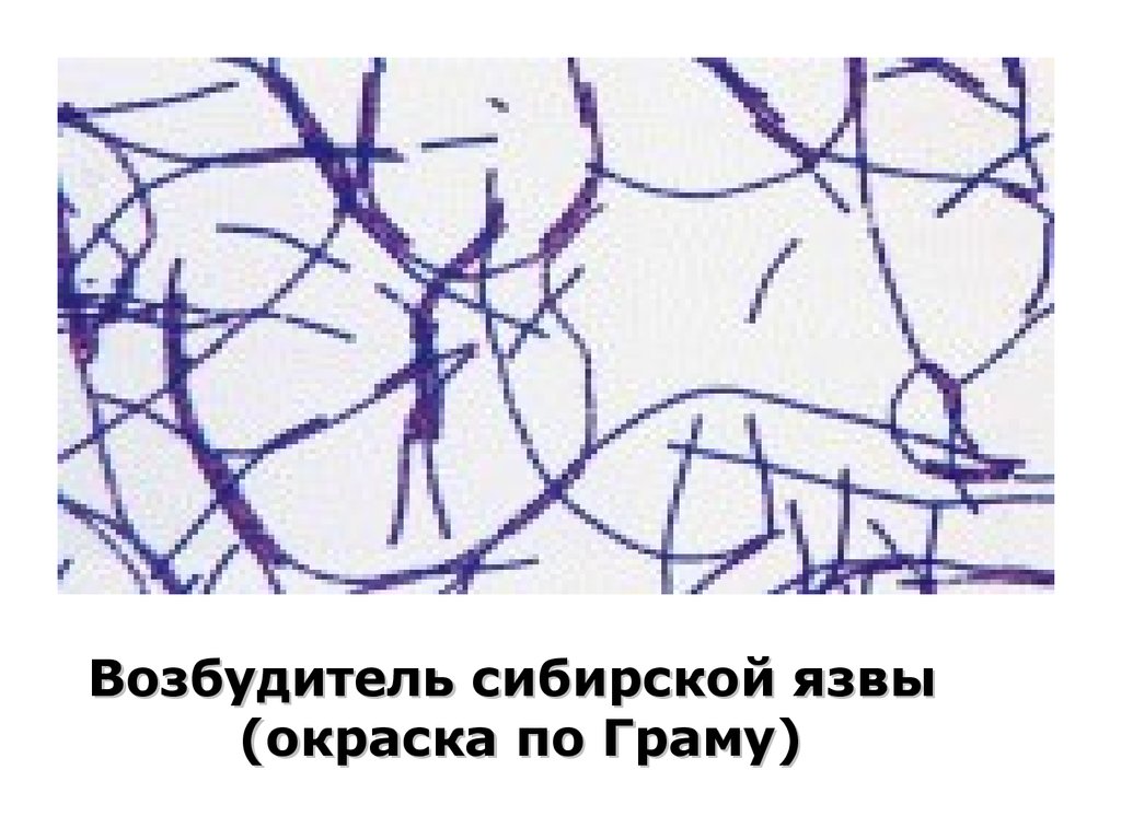 Возбудитель сибирской язвы. Возбудитель сибирской язвы микробиология. Бациллы сибирской язвы окраска по Граму. Сибирская язва микробиология окраска по Граму. Сибирская язва окраска по Граму.