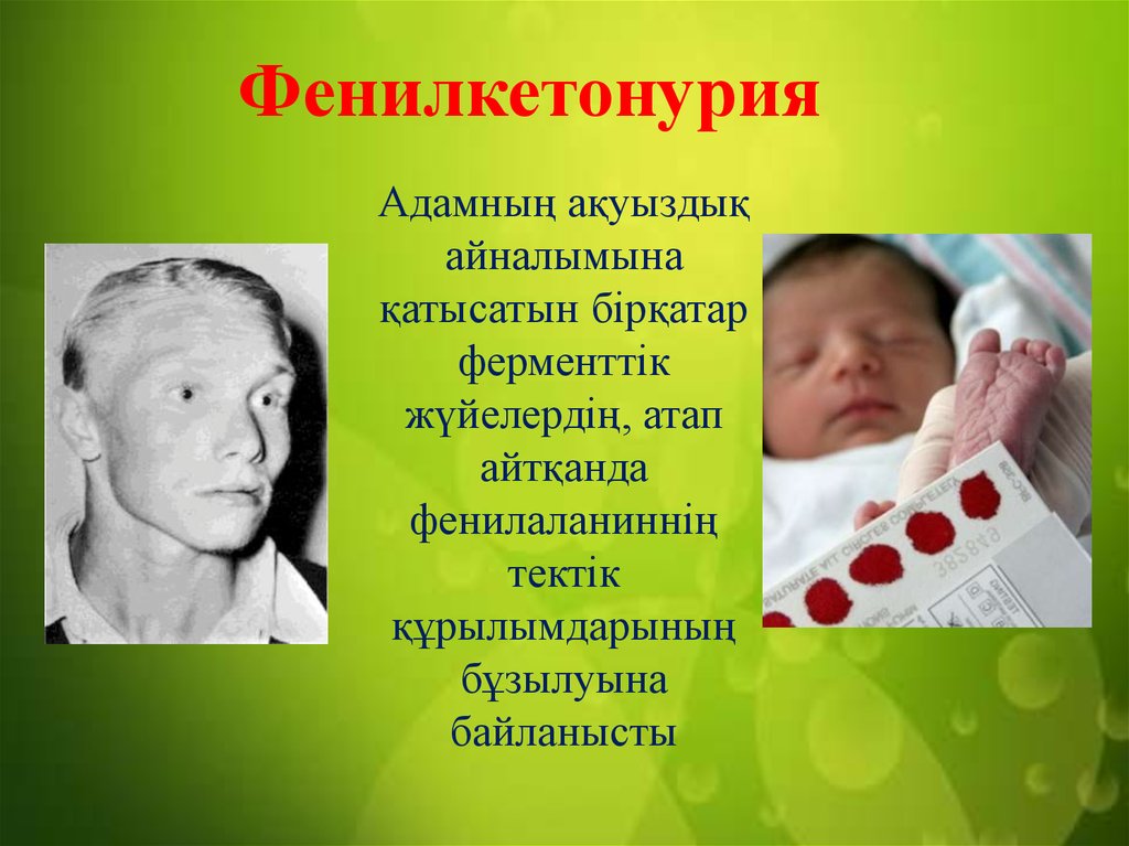 Фенилкетонурия генотип. Фенилкетонурия вид мутации. Фенилкетонурия у новорожденных. Презентация на тему фенилкетонурия.