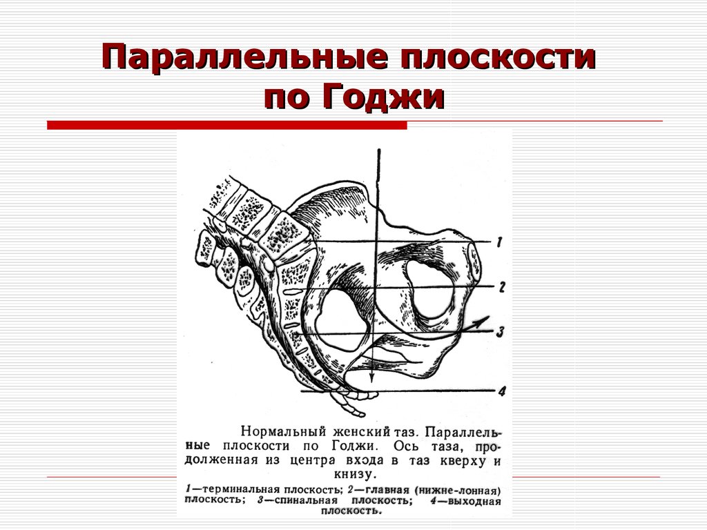 Размеры плоскостей малого таза. Параллельные плоскости в акушерстве. Плоскости и Размеры малого таза. Параллельные плоскости годжи Акушерство. Параллельные плоскости таза в акушерстве.