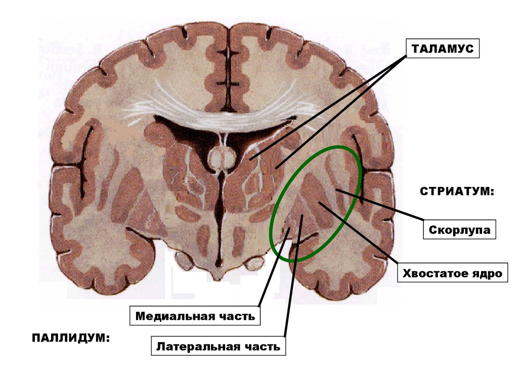 Хвостатое ядро мозга. Стриатум и паллидум. Стриатум и таламус. Хвостатое ядро головного мозга. Хвостатое ядро анатомия.