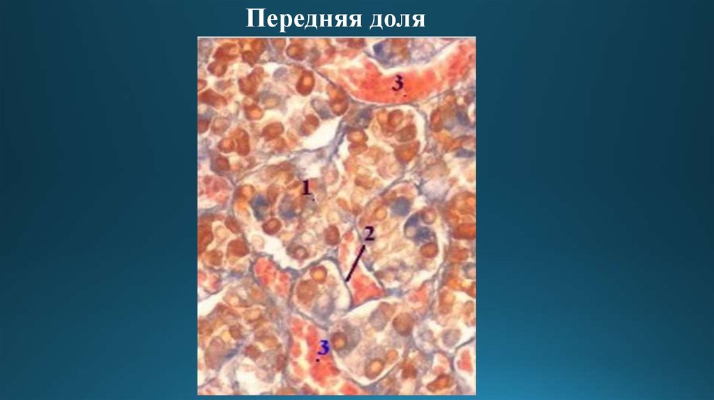 Гипофиз - online presentation