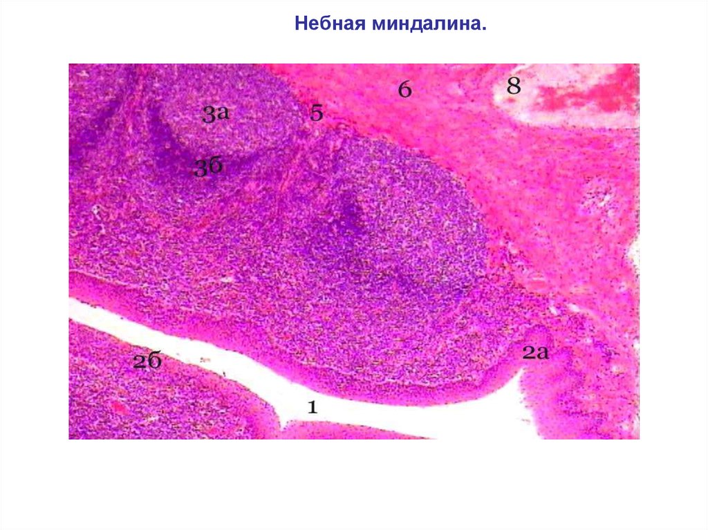 Небная миндалина гистология рисунок