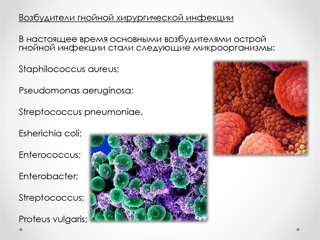 Хирургическая инфекция тест с ответами