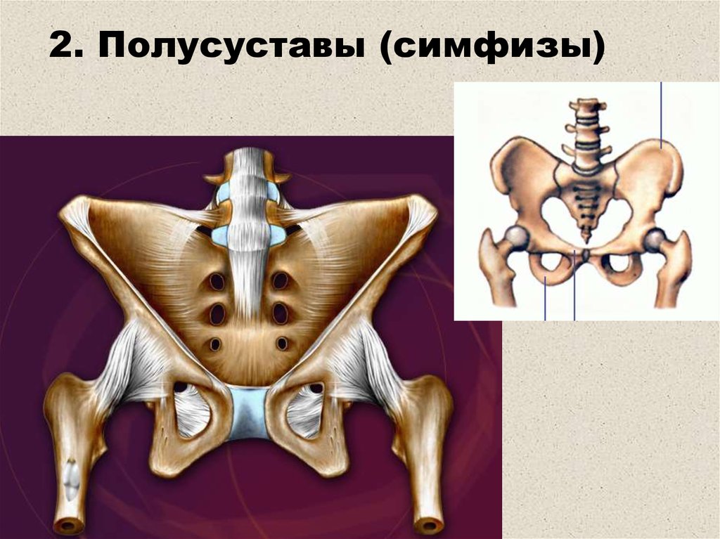 Симфиз это в анатомии. Полусуставы симфизы. Симфизы соединения костей. Лобковый симфиз полусустав кости. Строение симфиза.