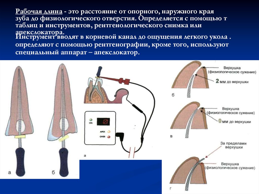 Регенеративная эндодонтия презентация