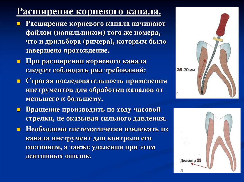 Повторное эндодонтическое лечение презентация