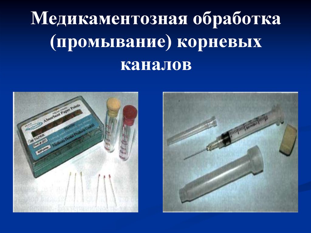 Чем промывают каналы. Медикаментозная обработка корневых каналов. Медикаментозные средства для обработки корневых каналов. Методы медикаментозной обработки корневых каналов. Препараты для медикаментозной обработки корневого канала.