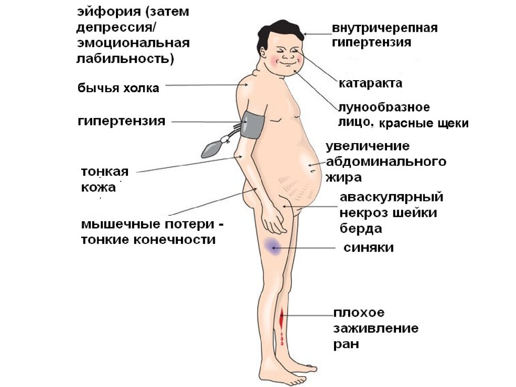 Причины диабета у мужчин. Признаки сахарного диабета у мужчин. Проявления сахарного диабета у мужчин. Низкий сахар симптомы у мужчин. Диабет симптомы у мужчин первые.