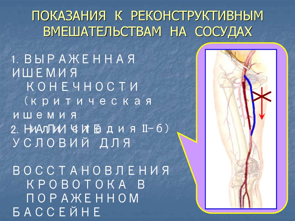 ПОКАЗАНИЯ К РЕКОНСТРУКТИВНЫМ ВМЕШАТЕЛЬСТВАМ НА СОСУДАХ