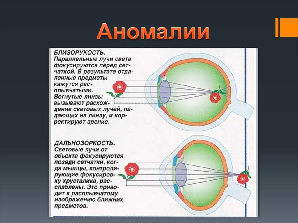 При близорукости лучи света фокусируются. Лучи позади сетчатки. Зрительный анализатор таблица. Возможна аномалия близорукость. Лучи света фокусируются за сетчаткой