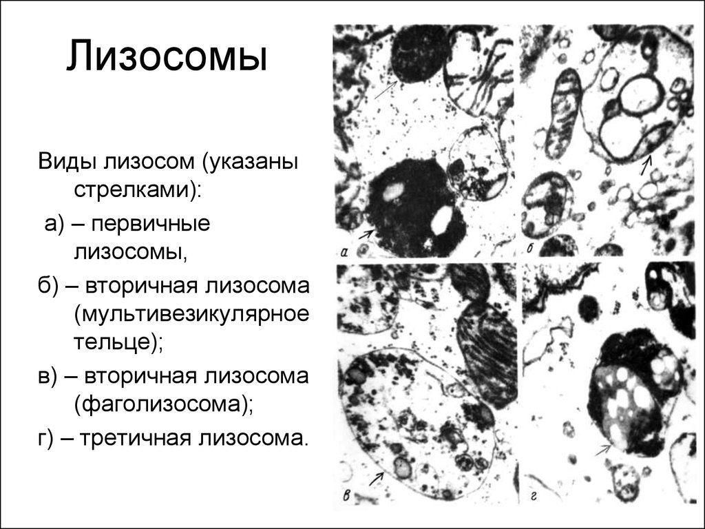 Вторичная лизосома. Электронограмма первичной лизосомы. Первичная и вторичная лизосома рисунок. Классификация лизосом. Строение структура лизосомы.