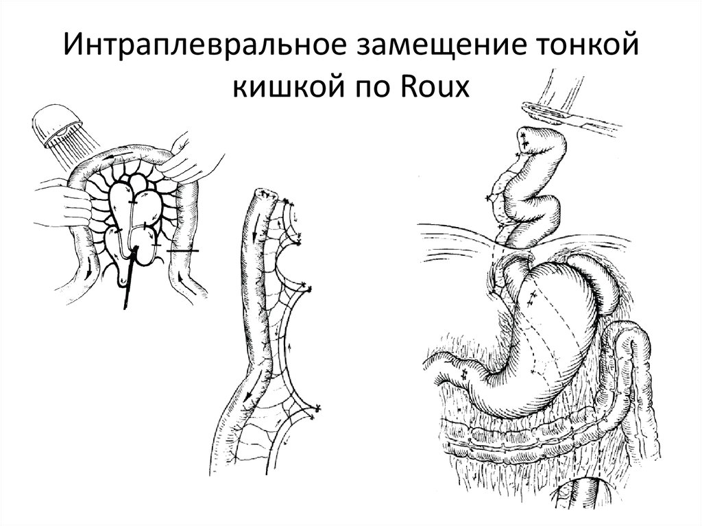 Операция герлока схема