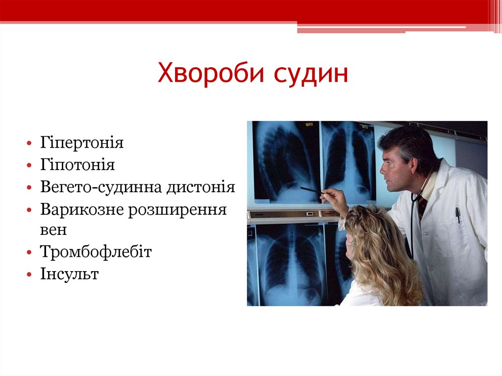 Хвороби судин