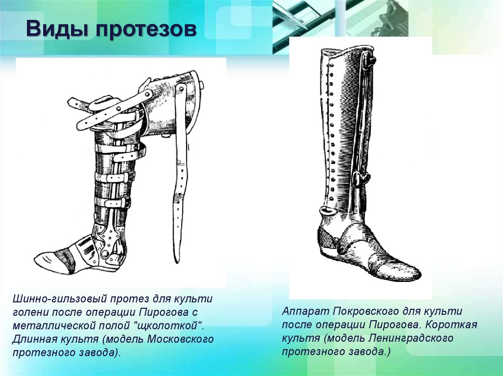 Протез культи