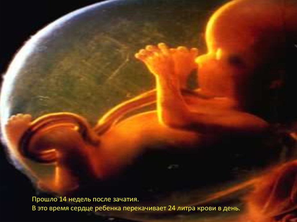 Токсикоз на 12 неделе. Плод на 12 неделе беременности. Эмбрион человека 12 недель беременности. Плод на 14 неделе беременности.