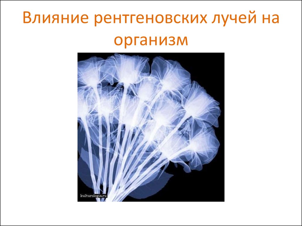 Влияние рентгеновского излучения на организм человека проект