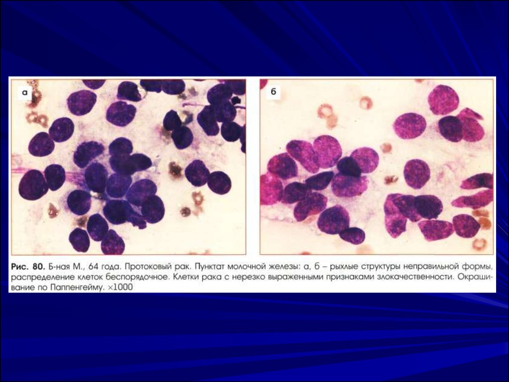 Цитологическая диагностика заболеваний молочной железы презентация