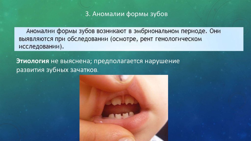 Аномалии формы зубов - презентация онлайн