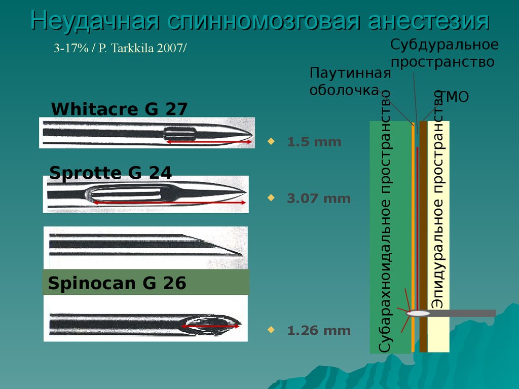 Спинальная анестезия. Спинномозговая анестезия оболочки. Спинномозговая анестезия методика. Субдуральная анестезия. Спинномозговая анестезия техника.