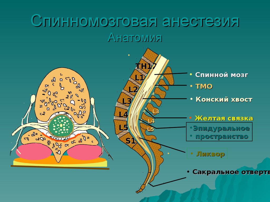 Спинномозговая анестезия презентация