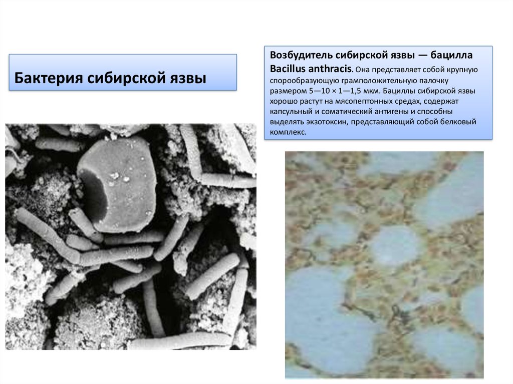 Бациллы сибирской язвы презентация