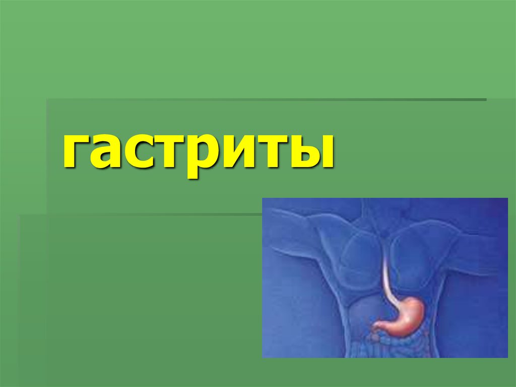 Гастрит презентация по терапии