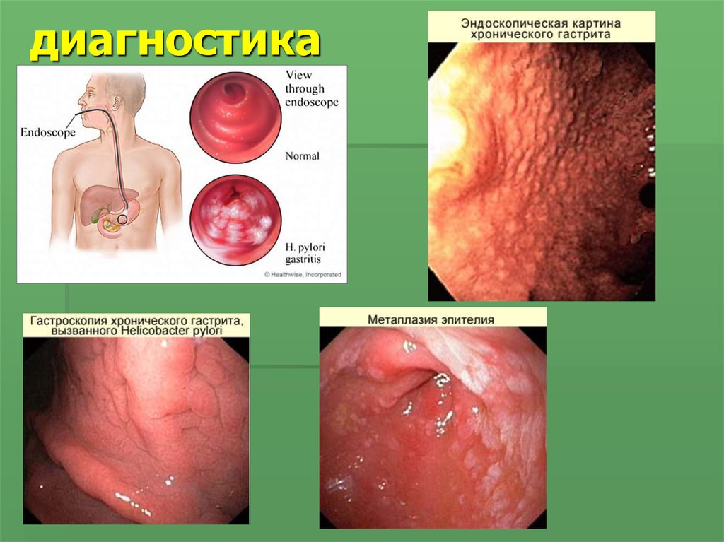 диагностика