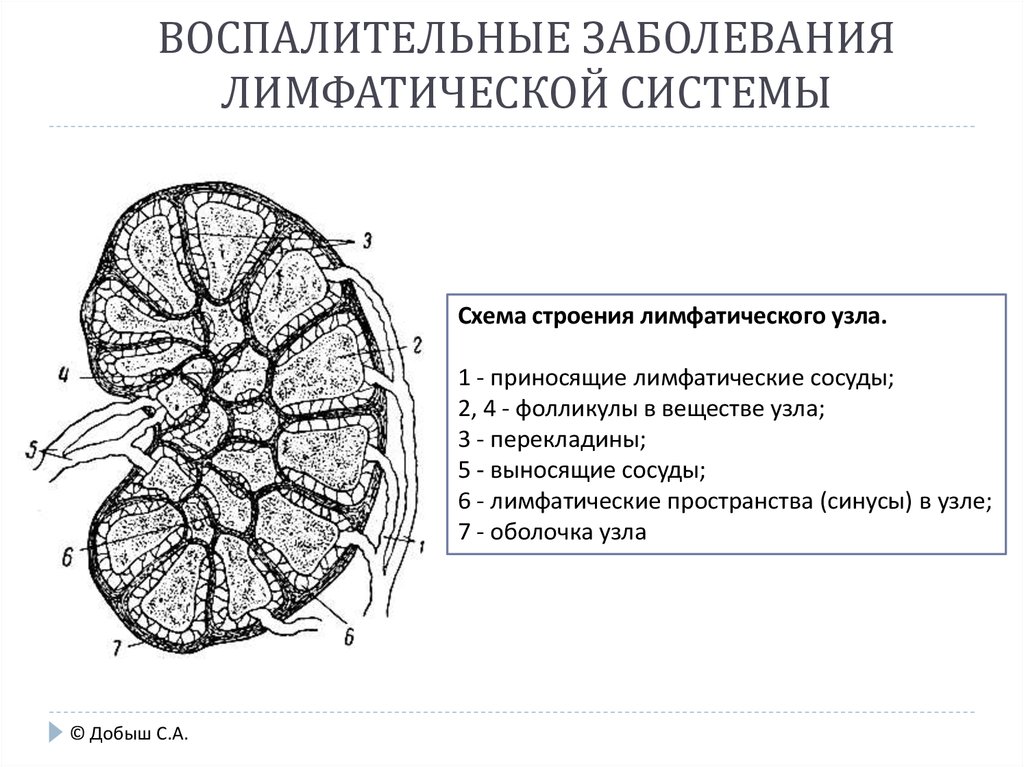 Лимфоузлы структурны. Схема строения лимфатического узла. Строение лимфатического узла анатомия. Схема строения лимфатического узла иммунология. Структура лимфатического узла рисунок.