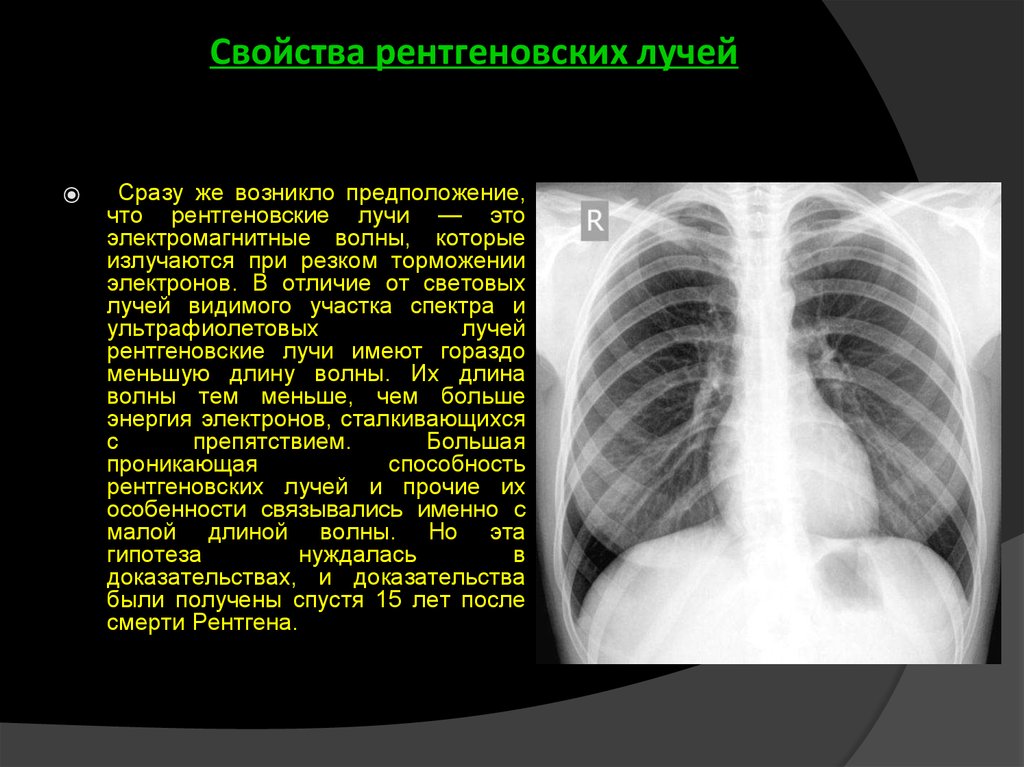 Как необходимо направлять пучок рентгеновских лучей для получения раздельного теневого изображения