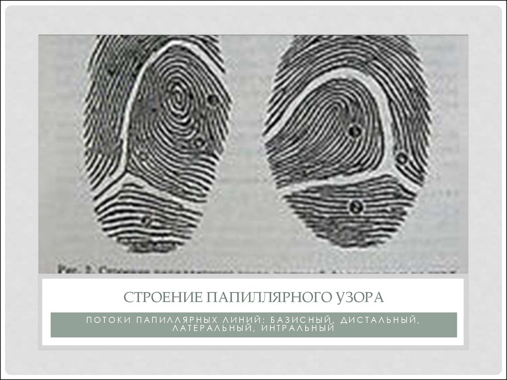 Признаки папиллярных узоров. Зоны папиллярного узора пальца руки. Латеральная зона папиллярного узора. Дельта папиллярного узора пальца руки. Базисная зона папиллярного узора.