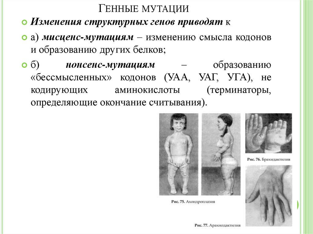 Генные мутации примеры. Генные мутации. Примеры ненной мутация. Примеры генных мутаций у человека.