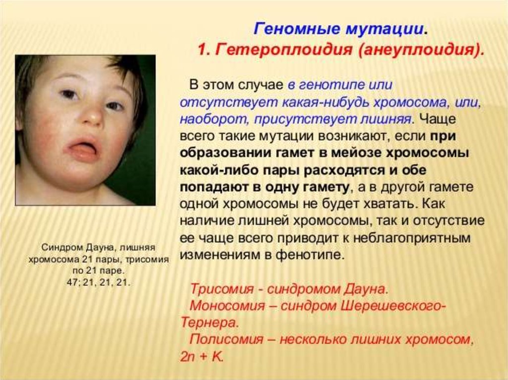 Синдром дауна лишняя хромосома. Пример геннотипной мутации. Примеры генномные мутаций у человека. Геномные заболевания человека. Примеры болезней мутаций.