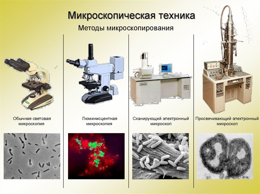 Микроскопией называют метод микроскопии. Микроскопия метод исследования в биологии. Электронная микроскопия. Современные электронные микроскопы. Методы микроскопии в биологии.