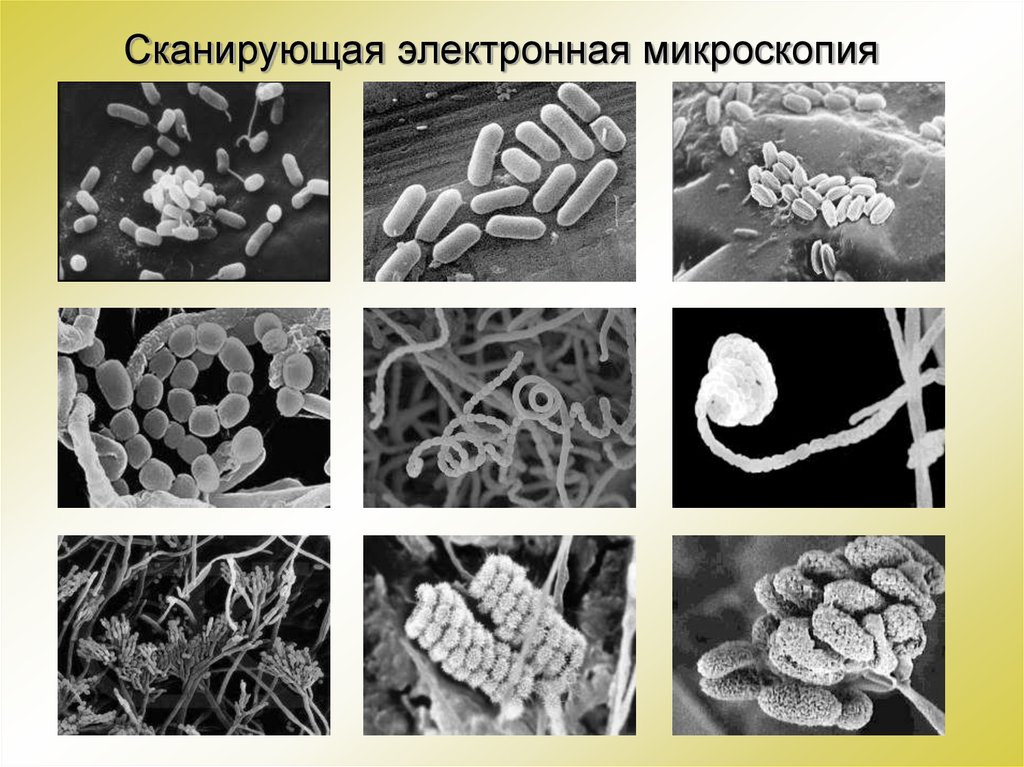 Сканирующий электронный. Сканирующая электронная микроскопия микроскоп. Метод сканирующей (растровой) электронной микроскопии. Сканирующая микроскопия метод. Метод сканирующей электронной микроскопии.