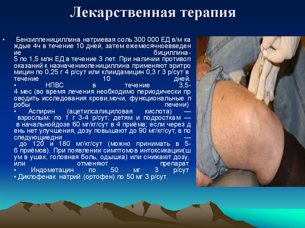 Лекарственная терапия