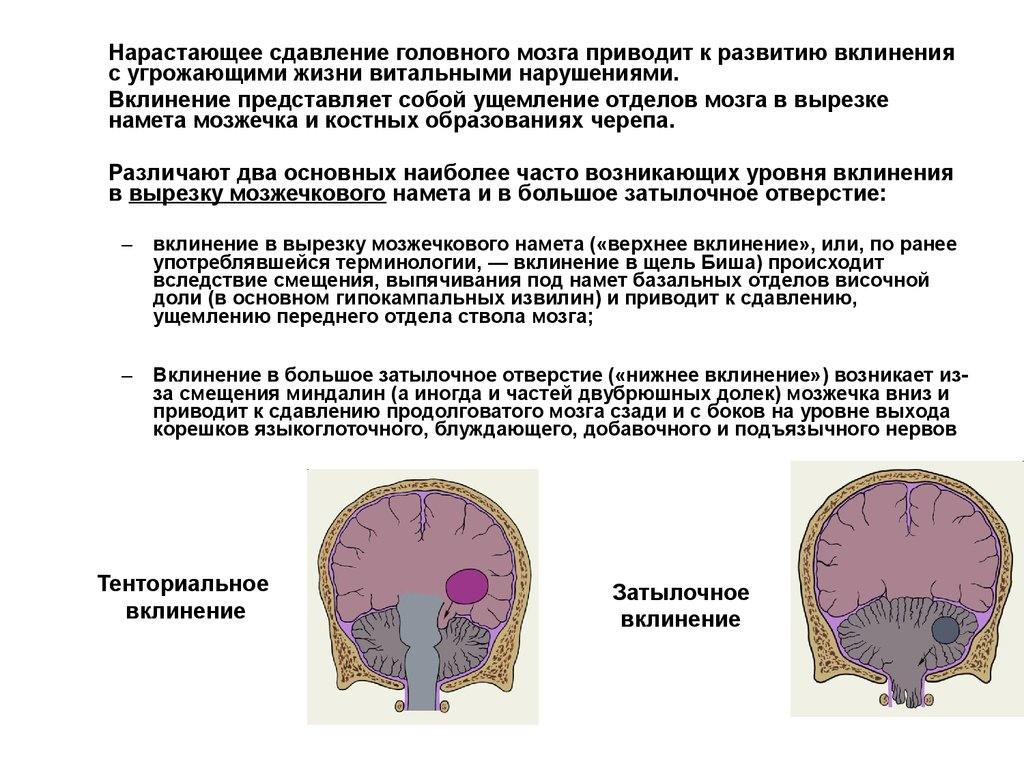 Сдавление мозга признаки. Вклинивание ствола мозга симптомы. Вклинение миндалин мозжечка кт. Вклинение головного мозга кт. Дислокация миндалин мозжечка кт.