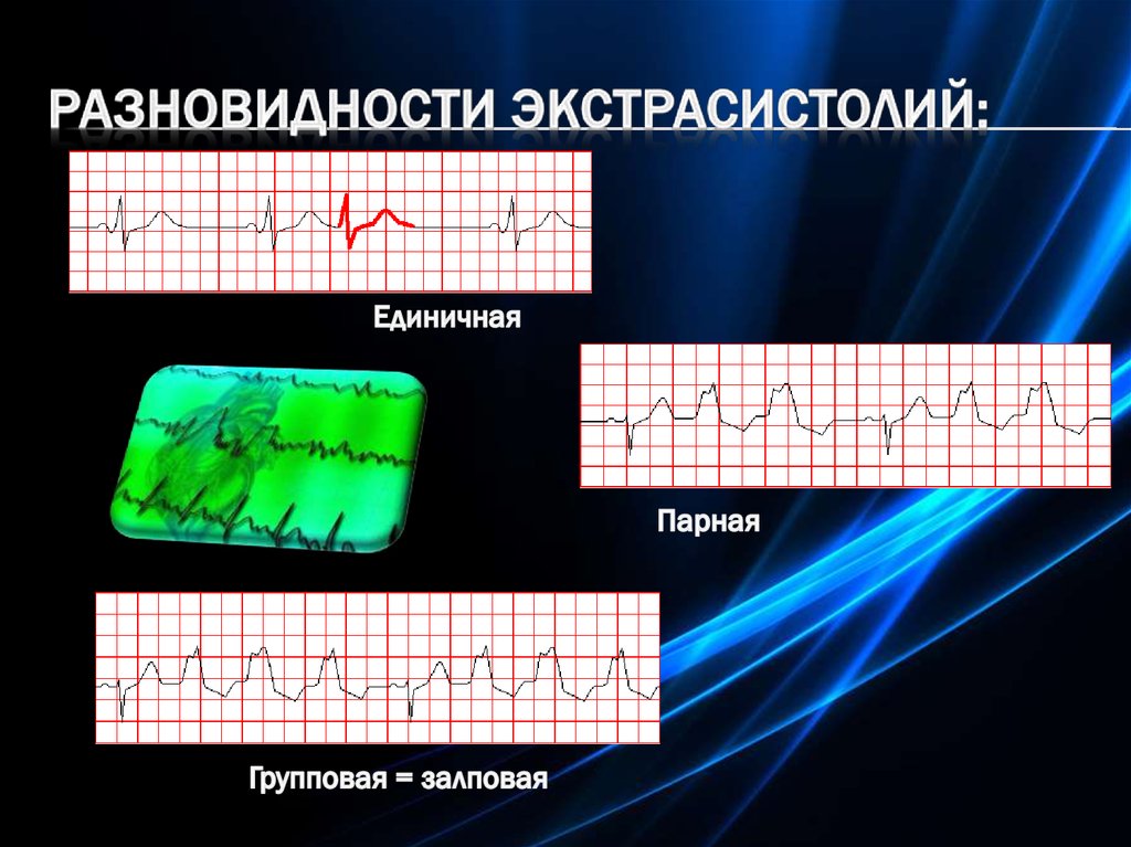 Единичная парная