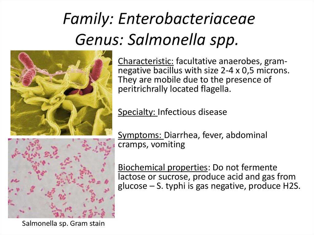 Salmonellose infections. Microbiological characteristic and diagnostic