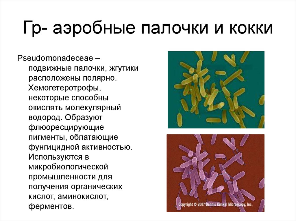 Кокковые бактерии. Микроорганизмы кокки палочки. Грамотрицательные аэробные палочки. Палочки кокки бациллы. Характеристика бактерий палочки кокки.