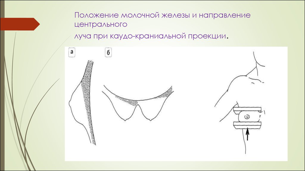 Молочные железы типы желез