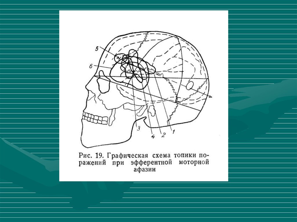 Лурия схема нейропсихологического исследования