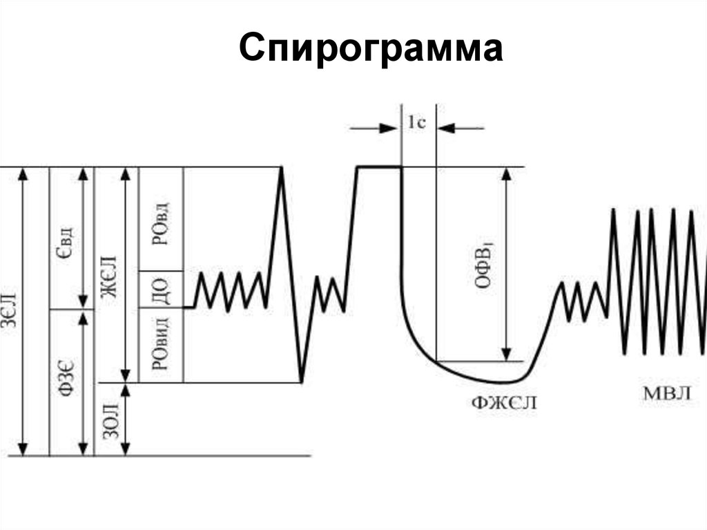 Максимальная вентиляция легких мвл формула расчета. Спирограмма жизненной емкости легких. Спирограмма физиология график. Спирограмма схема физиология. Показатели спирограммы физиология.