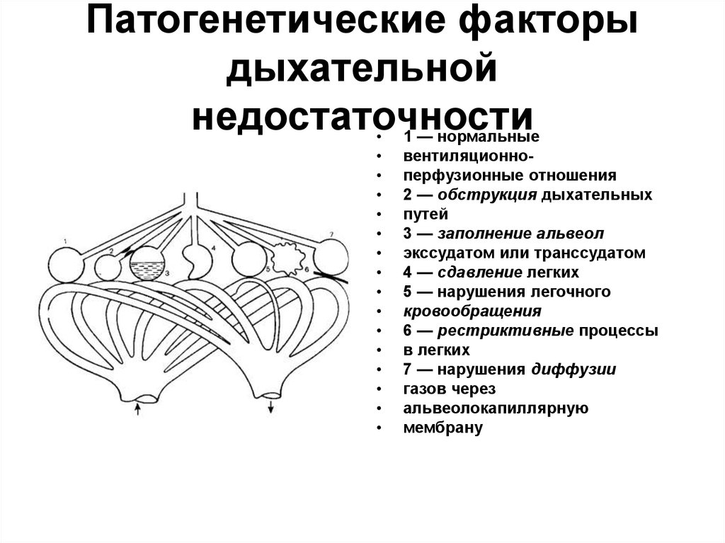 Факторы дыхания. Патогенетическая классификация дыхательной недостаточности. Патогенетические факторы дыхательной недостаточности. Патогенетический фактор недостаточности внешнего дыхания. Патогенетические механизмы дыхательной недостаточности.