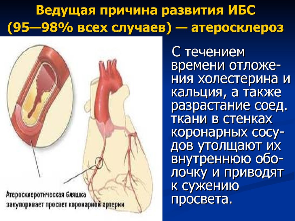 Ишемия передней стенки. ИБС атеросклеротическая болезнь сердца. Факторы развития атеросклероза. Развитию атеросклероза и ИБС способствуют.