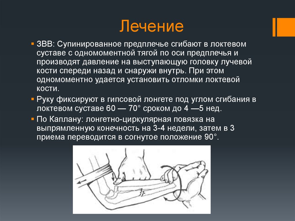 Первая помощь при вывихе локтевого сустава