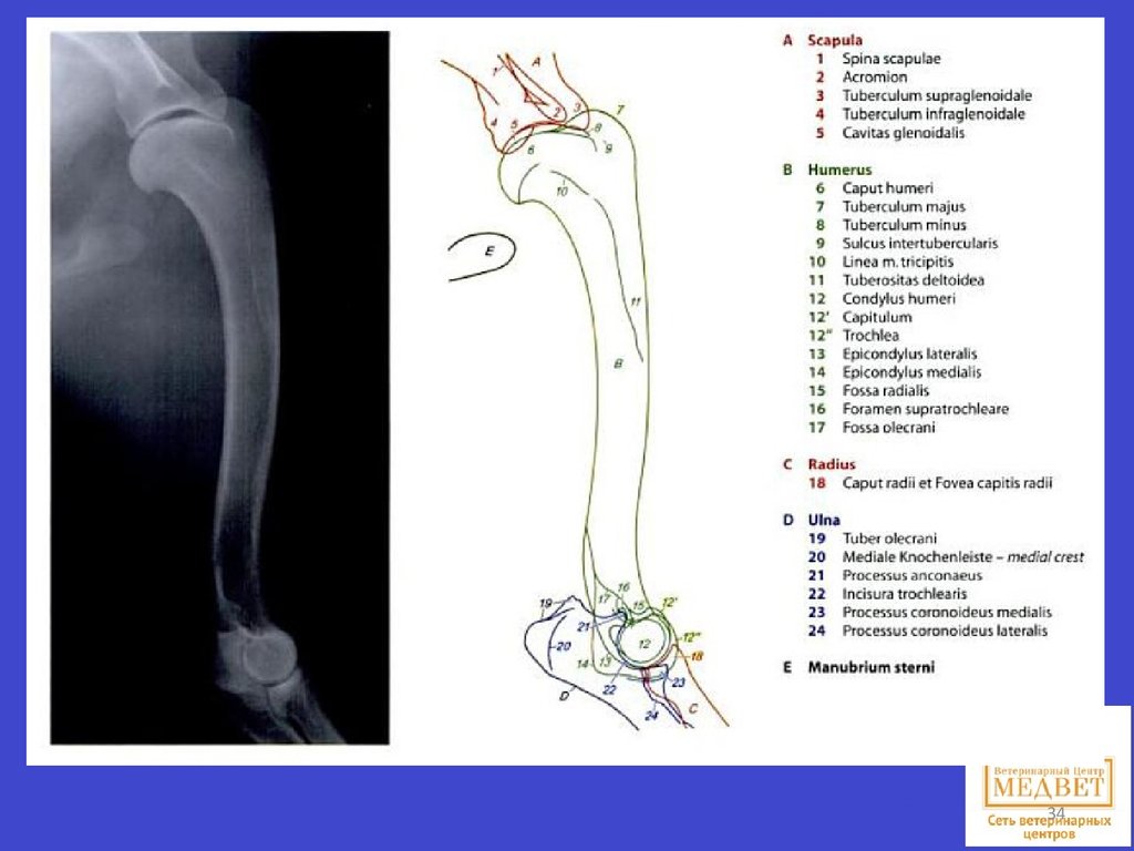 Tuberculum supraglenoidale. Туберкулум супраглеоноидале. Tuberculum supraglenoidale анатомия. Tuberculum supraglenoidale животных. Fossa olecrani кость.